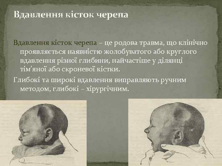 Вдавлення кісток черепа – це родова травма, що клінічно проявляється наявністю жолобуватого або круглого