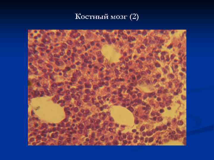 Костный мозг (2) 