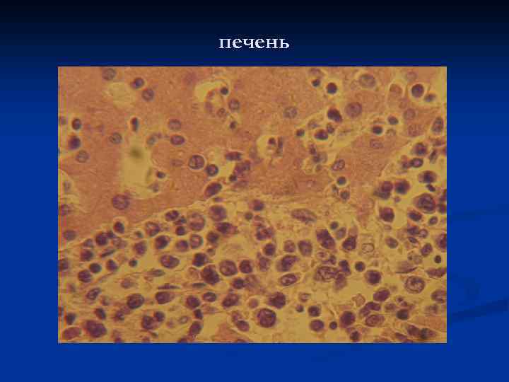 печень 