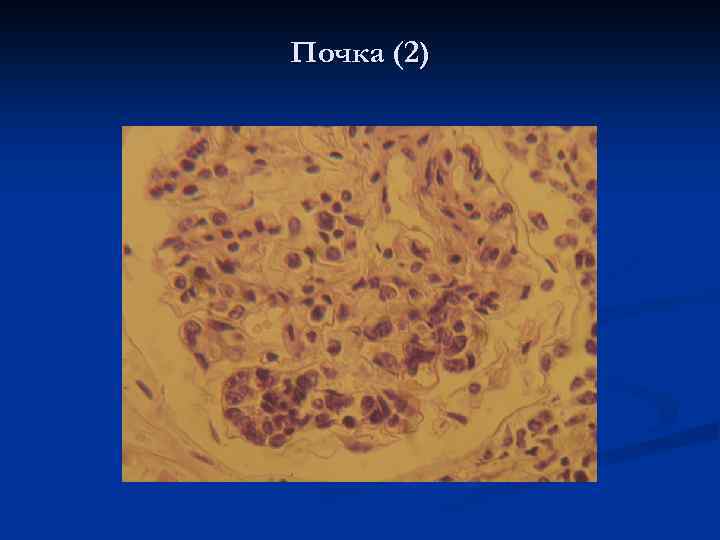 Почка (2) 