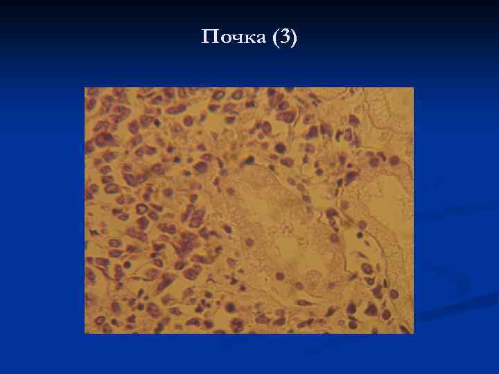 Почка (3) 
