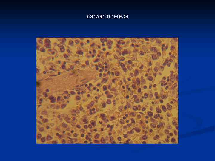 селезенка 