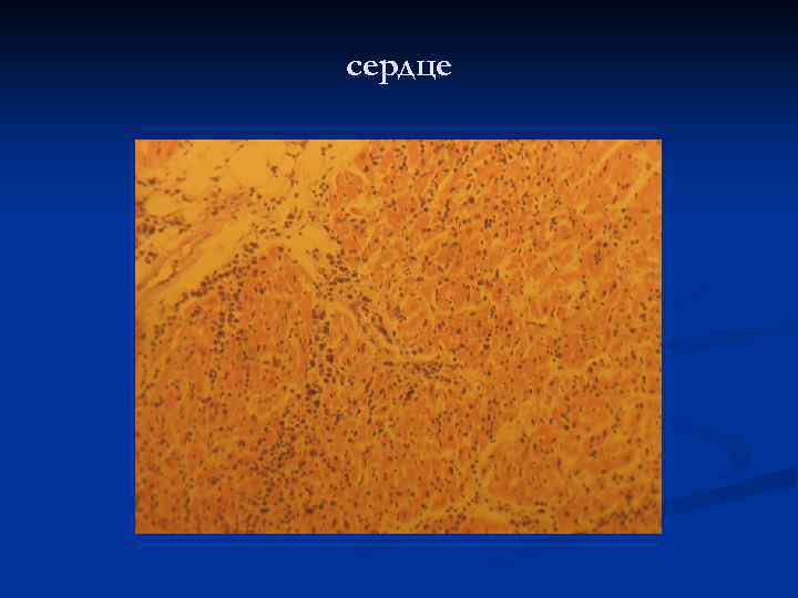 сердце 