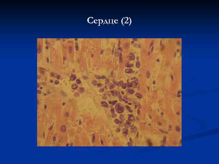 Сердце (2) 