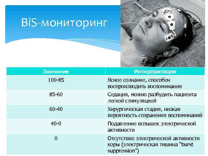 Bi. S-мониторинг Значение Интерпритация 100 -85 Ясное сознание, способен воспроизводить воспоминания 85 -60 Седация,