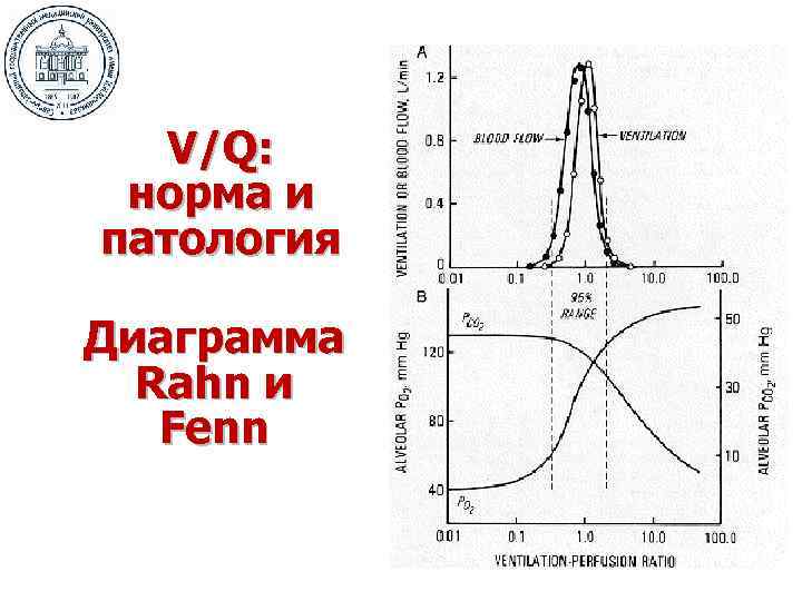 V/Q: норма и патология Диаграмма Rahn и Fenn 