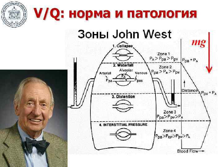 V/Q: норма и патология 