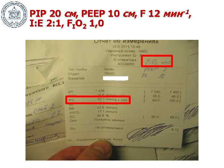 РIP 20 см, РЕЕР 10 см, F 12 мин-1, I: E 2: 1, FIO