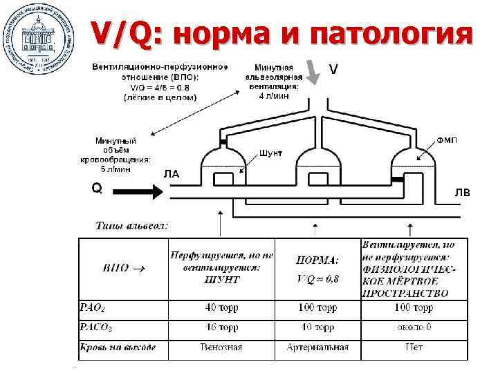 V/Q: норма и патология 