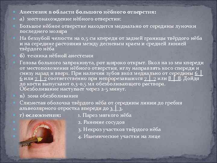  Анестезия в области большого нёбного отверстия: а) местонахождение нёбного отверстия: Большое нёбное отверстие