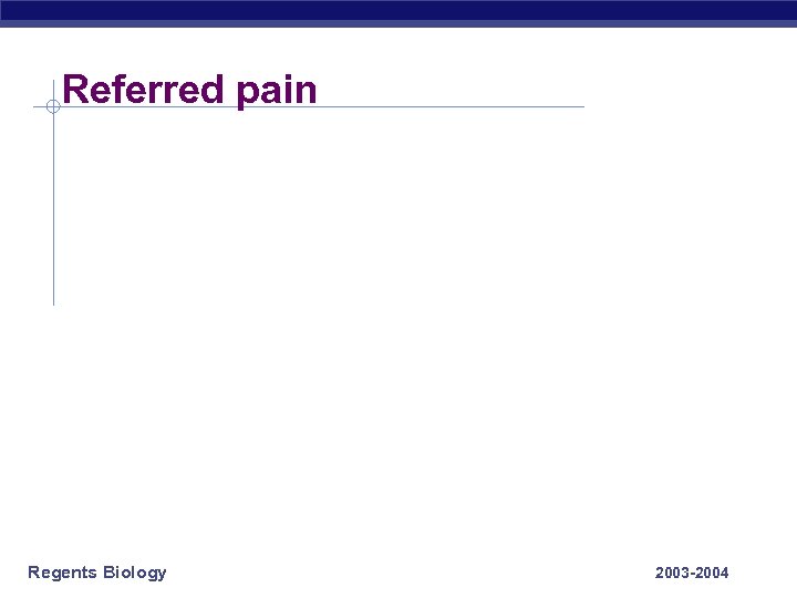 Referred pain Regents Biology 2003 -2004 