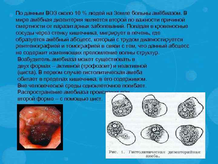 По данным ВОЗ около 10 % людей на Земле больны амёбиазом. В мире амёбная