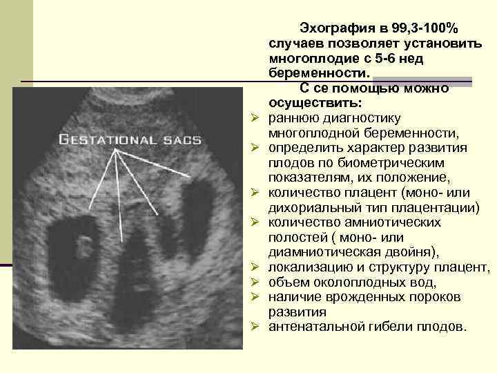 Ø Ø Ø Ø Эхография в 99, 3 -100% случаев позволяет установить многоплодие с