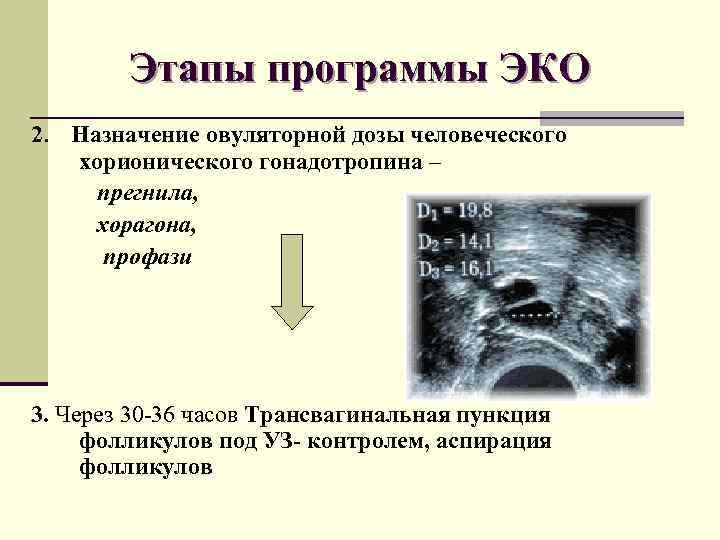Этапы программы ЭКО 2. Назначение овуляторной дозы человеческого хорионического гонадотропина – прегнила, хорагона, профази