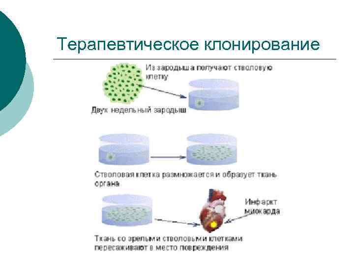 Терапевтическое клонирование 