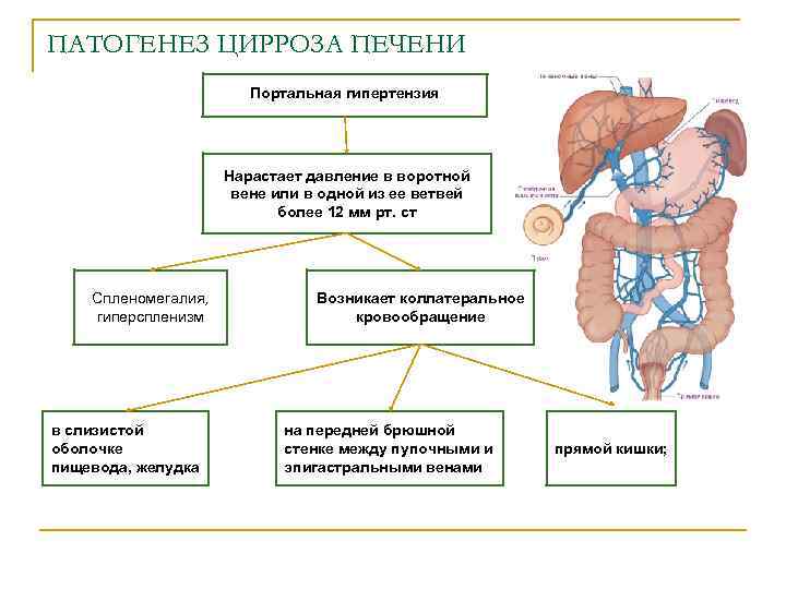 ПАТОГЕНЕЗ ЦИРРОЗА ПЕЧЕНИ Портальная гипертензия Нарастает давление в воротной вене или в одной из