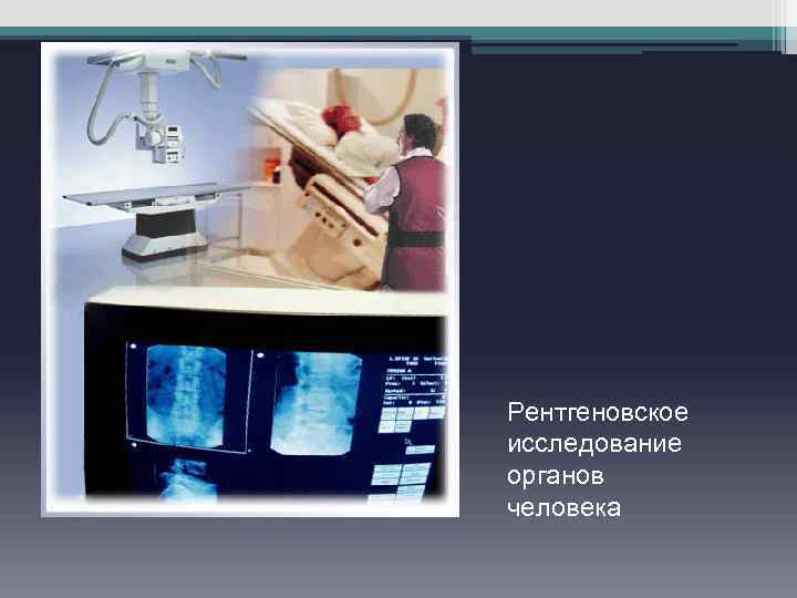 Рентгеновское исследование органов человека 