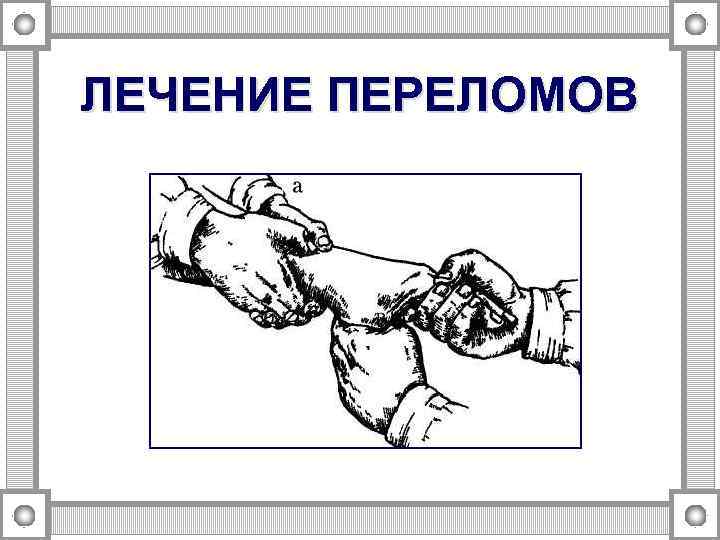 ЛЕЧЕНИЕ ПЕРЕЛОМОВ 