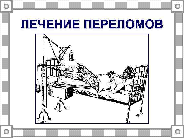 ЛЕЧЕНИЕ ПЕРЕЛОМОВ 