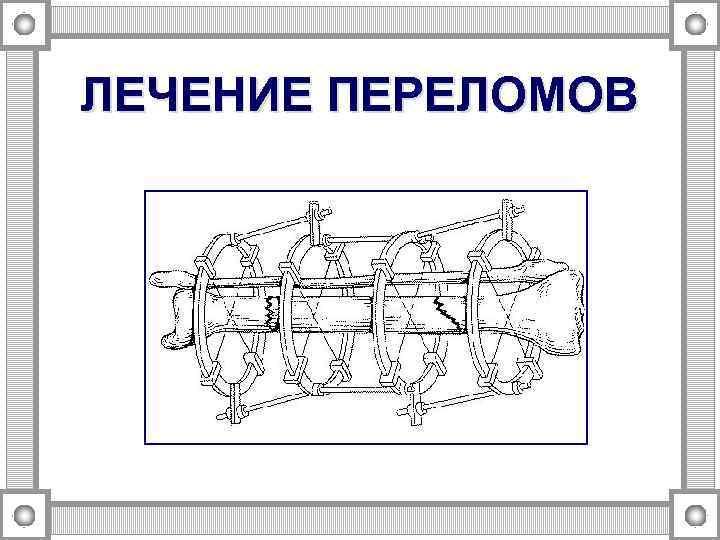 ЛЕЧЕНИЕ ПЕРЕЛОМОВ 