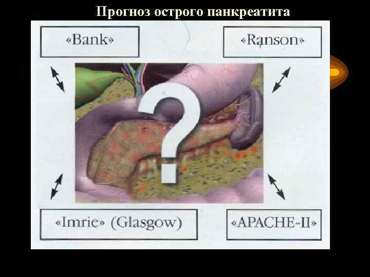 Прогноз острого панкреатита 