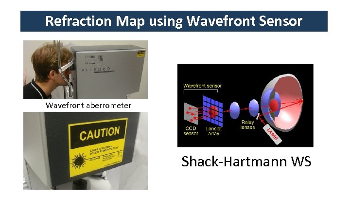 Refraction Map using Wavefront Sensor Wavefront aberrometer Shack-Hartmann WS 