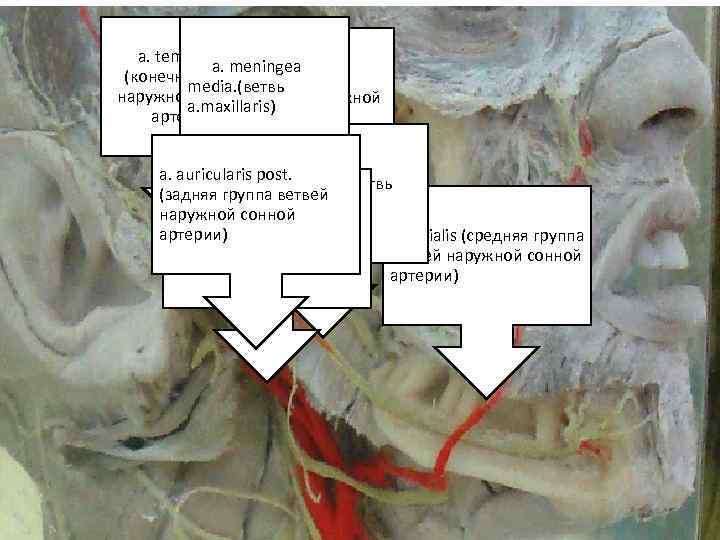 Тт. а. temporalis sfc Тт. а. meningea (конечная ветвь а. maxillaris (средняя media. (ветвь