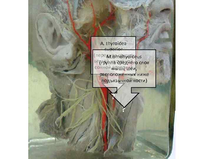 A. thyroidea superior (передняя группа M. omohyoideus ветвей наружной слоя (группа среднего сонной мышц