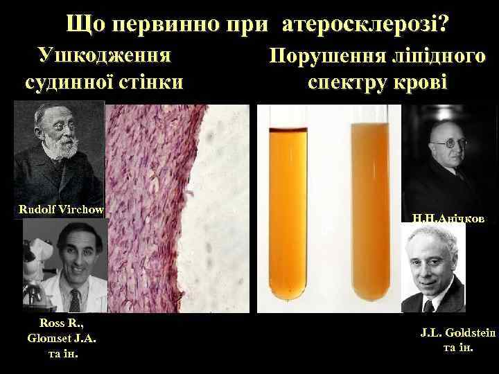 Що первинно при атеросклерозі? Ушкодження судинної стінки Rudolf Virchow Ross R. , Glomset J.