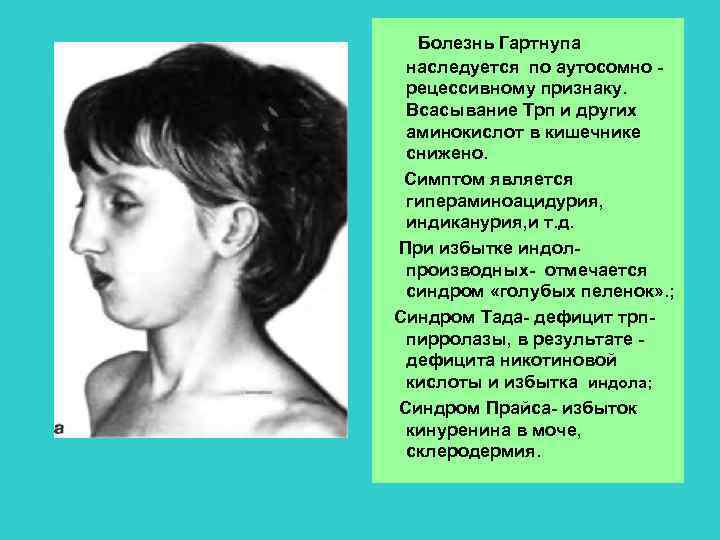 Болезнь Гартнупа наследуется по аутосомно рецессивному признаку. Всасывание Трп и других аминокислот в кишечнике