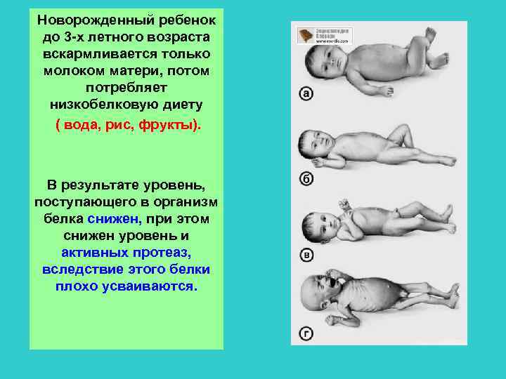 Новорожденный ребенок до 3 -х летного возраста вскармливается только молоком матери, потом потребляет низкобелковую