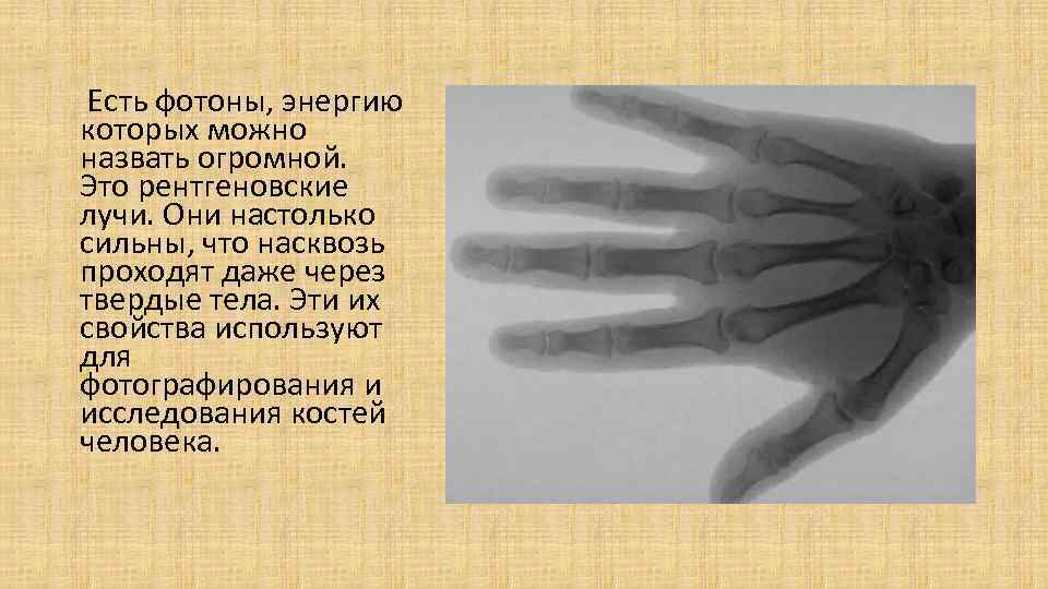 Есть фотоны, энергию которых можно назвать огромной. Это рентгеновские лучи. Они настолько сильны, что