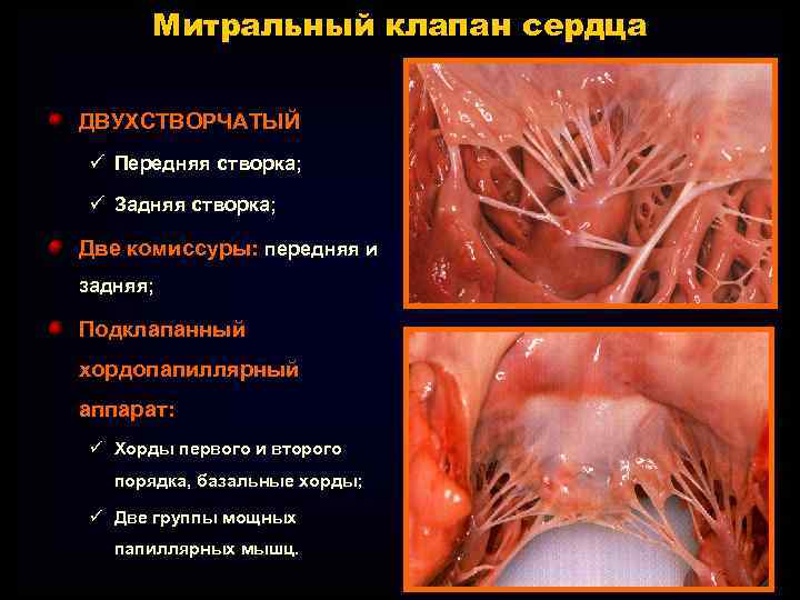 Митральный клапан сердца ДВУХСТВОРЧАТЫЙ ü Передняя створка; ü Задняя створка; Две комиссуры: передняя и