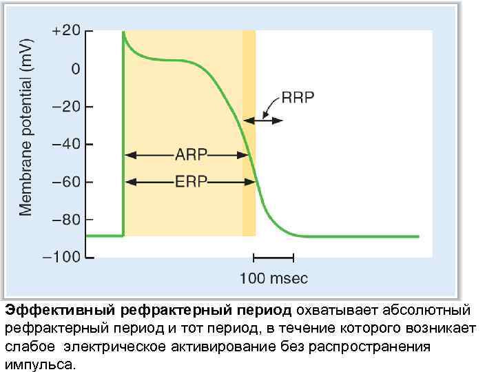 Эффективный рефрактерный период охватывает абсолютный рефрактерный период и тот период, в течение которого возникает
