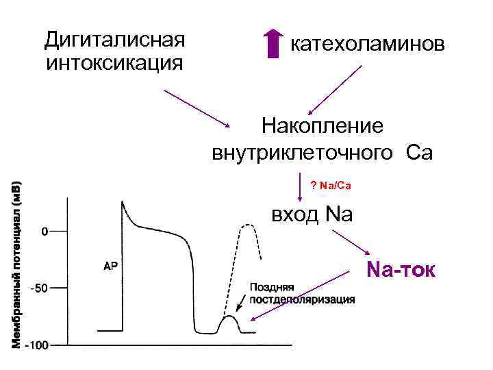 Дигиталисная интоксикация катехоламинов Накопление внутриклеточного Са ? Na/Ca вход Na Na-ток 