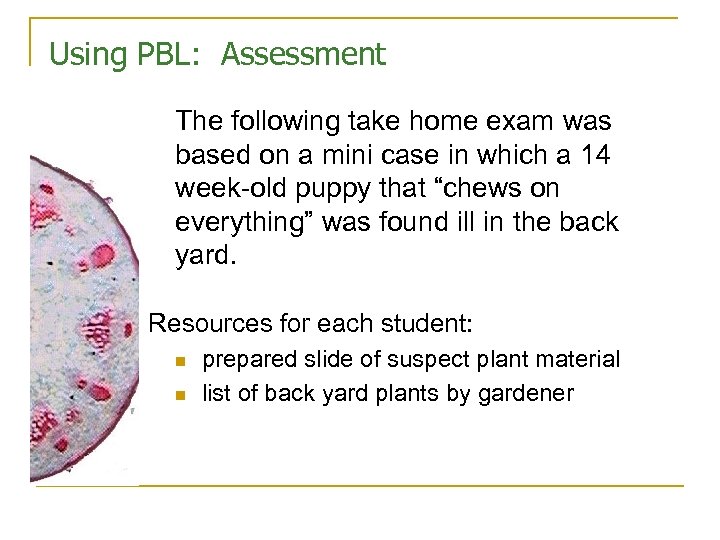 Using PBL: Assessment The following take home exam was based on a mini case