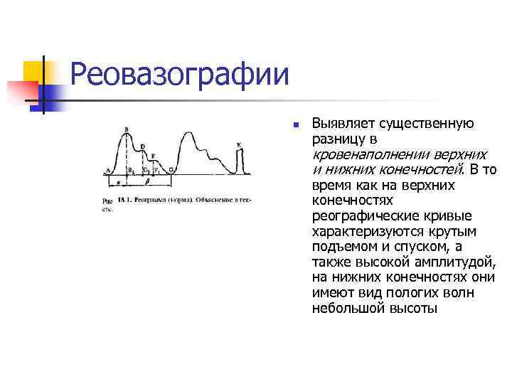 Реовазографии n Выявляет существенную разницу в кровенаполнении верхних и нижних конечностей. В то время