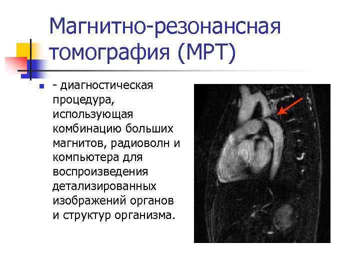 Магнитно-резонансная томография (МРТ) n - диагностическая процедура, использующая комбинацию больших магнитов, радиоволн и компьютера