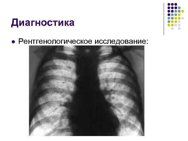 Диагностика l Рентгенологическое исследование: 