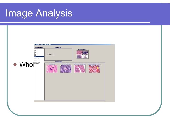 Image Analysis l Whole-Slide Image Processing 