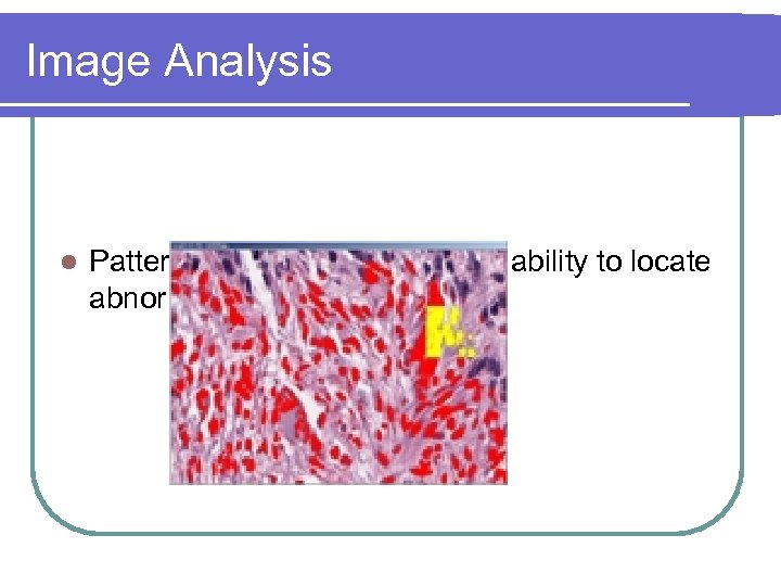 Image Analysis l Pattern of pixels for Nuclei and ability to locate abnormal clustering.