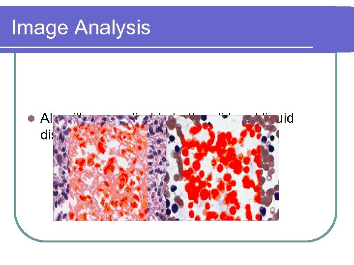 Image Analysis l Algorithms applied to both solid and liquid diseases. 