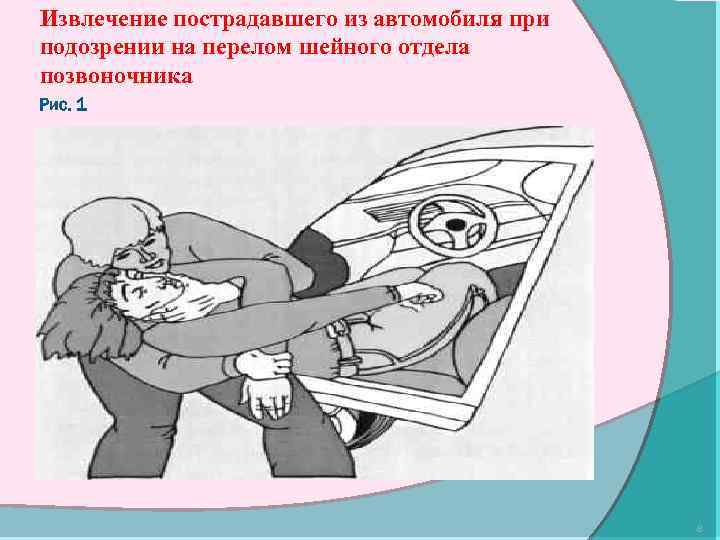 Извлечение пострадавшего из автомобиля при подозрении на перелом шейного отдела позвоночника Рис. 1 8