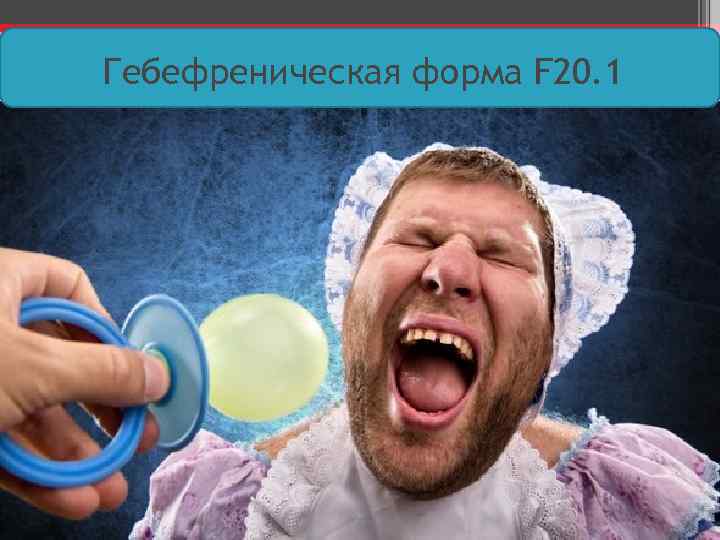 Гебефреническая форма F 20. 1 