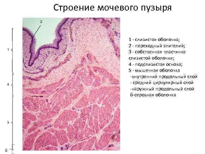 Слизистый пузырь. Мочевой пузырь гистология препарат. Стенка мочевого пузыря гистология. Строение мочевого пузыря гистология. Мочевой пузырь препарат по гистологии.
