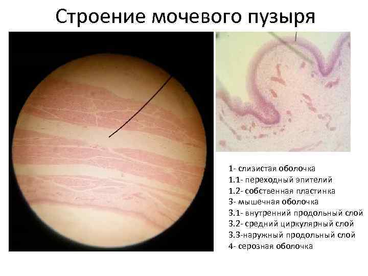 Строение мочевого пузыря 1 - слизистая оболочка 1. 1 - переходный эпителий 1. 2