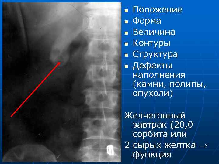 n n n Положение Форма Величина Контуры Структура Дефекты наполнения (камни, полипы, опухоли) Желчегонный