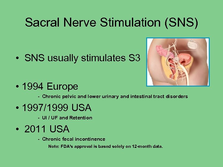Sacral Nerve Stimulation (SNS) • SNS usually stimulates S 3 • 1994 Europe -