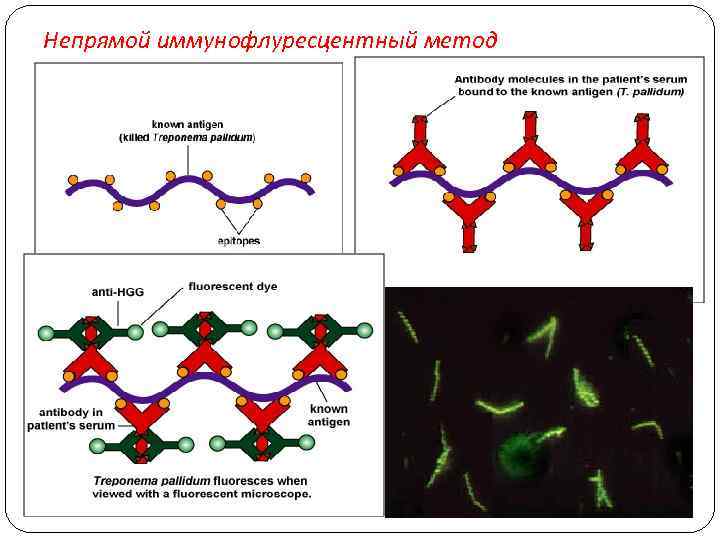 Непрямой иммунофлуресцентный метод 