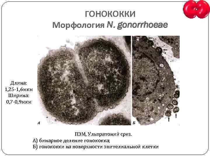 ГОНОКОККИ Морфология N. gonorrhoeae Длина: 1, 25 -1, 6 мкм Ширина: 0, 7 -0,